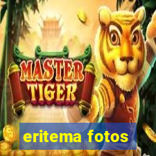 eritema fotos